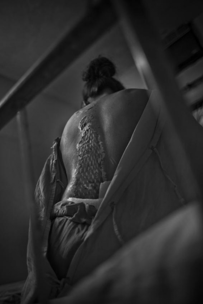 La educación de ácido en Bangladesh