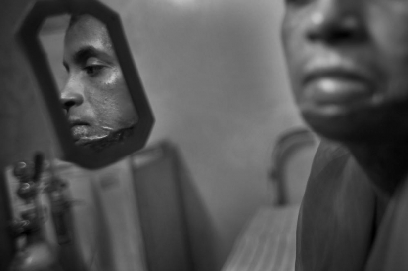 La educación de ácido en Bangladesh