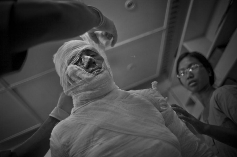 La educación de ácido en Bangladesh