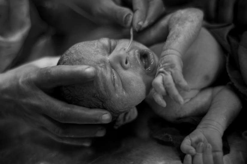 The education of acid in Bangladesh