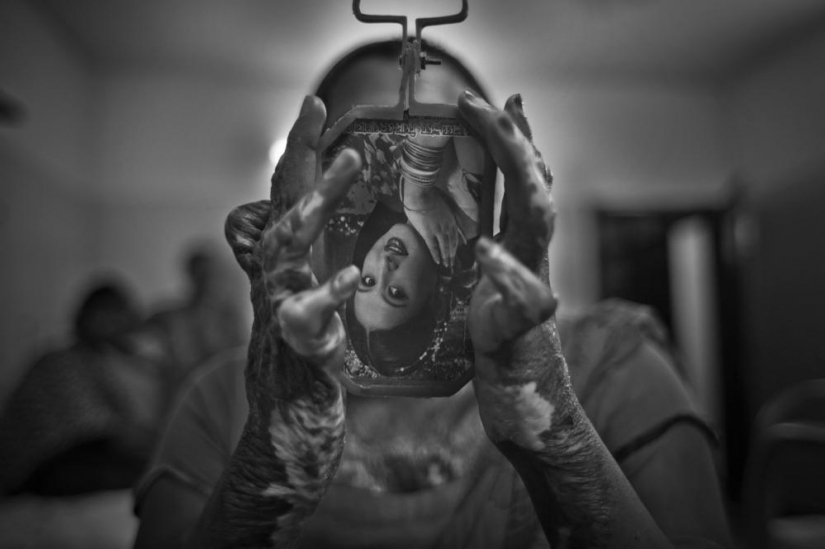 The education of acid in Bangladesh