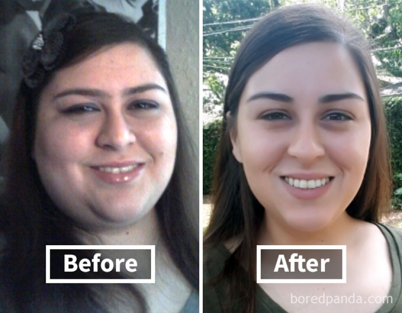 32 inspiring examples of how weight loss transforms the face