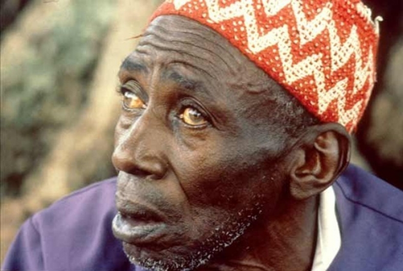 10 most terrifying parasites that can live in the human body