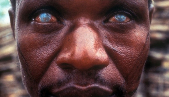 10 most terrifying parasites that can live in the human body