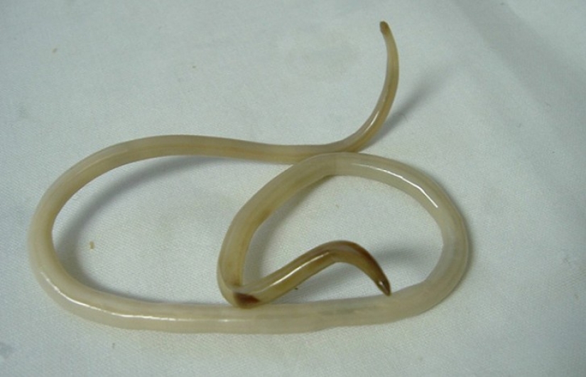 10 most terrifying parasites that can live in the human body