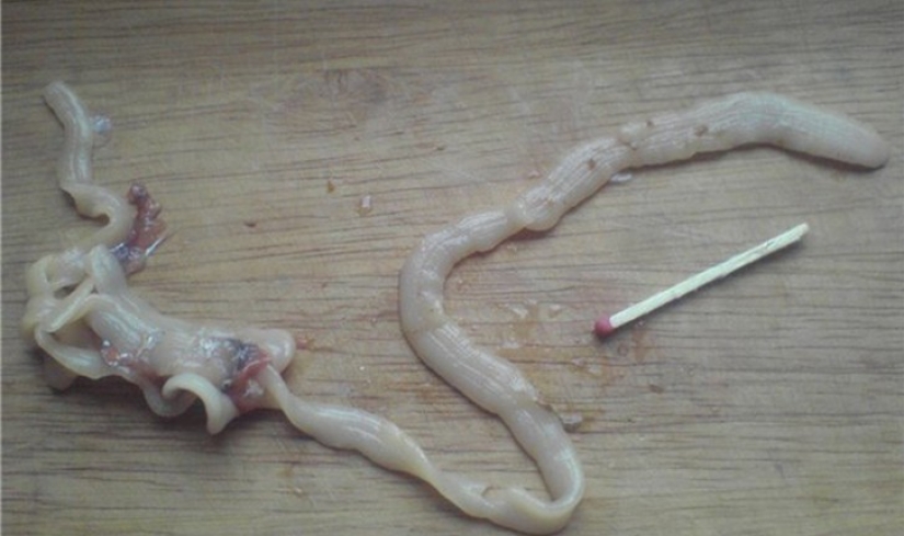10 más terroríficos de parásitos que pueden vivir en el cuerpo humano