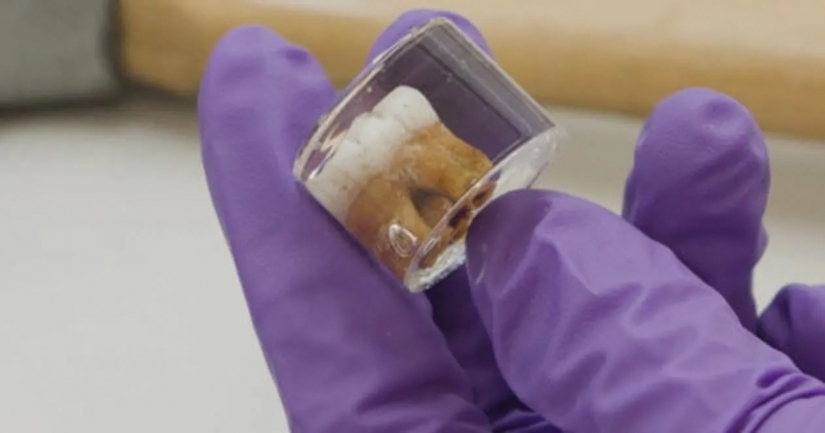 10 weird but fascinating problems of ancient people