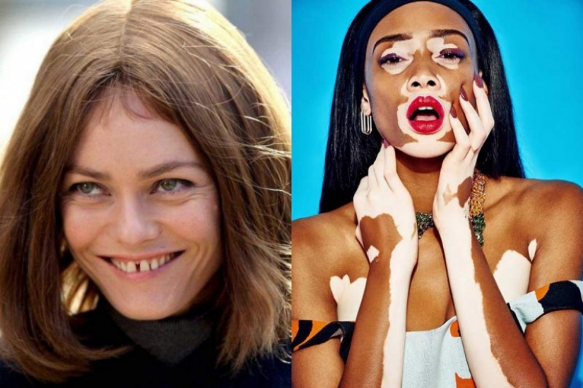 5 celebridades que nos encanta, a pesar de los defectos, en su apariencia