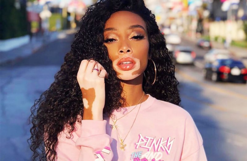 5 celebridades que nos encanta, a pesar de los defectos, en su apariencia