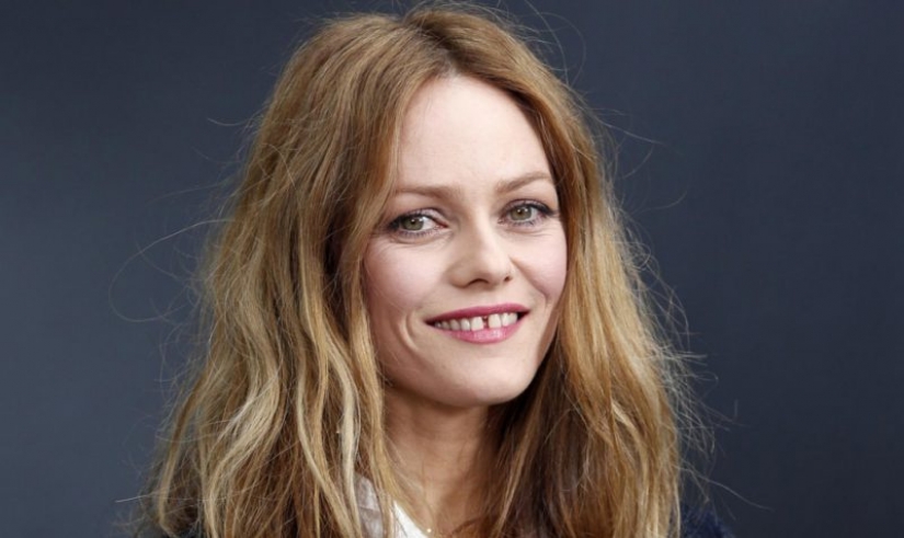 5 celebridades que nos encanta, a pesar de los defectos, en su apariencia