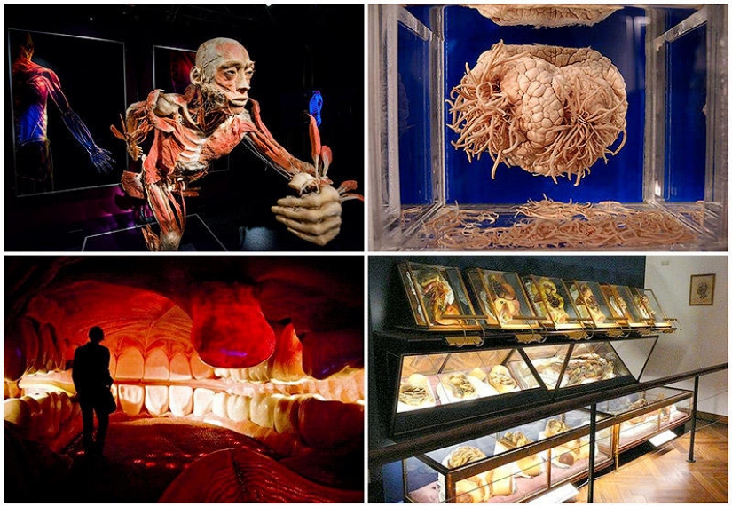 6 most shocking anatomical museums in the world