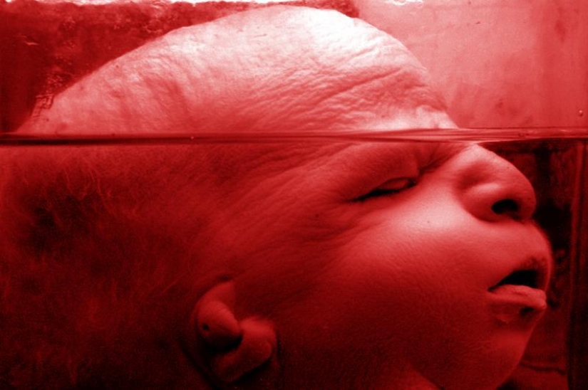 6 most shocking anatomical museums in the world