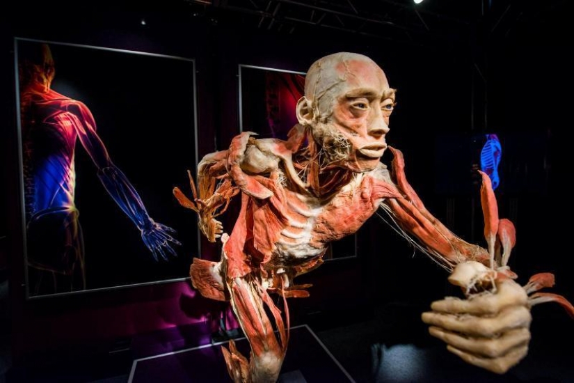 6 most shocking anatomical museums in the world