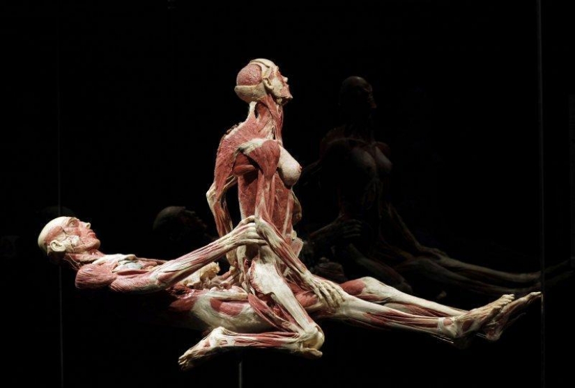 6 most shocking anatomical museums in the world
