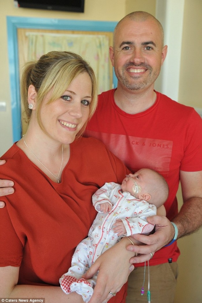 An amazing story of a tiny baby who survived in spite of everything An amazing story of a tiny baby who survived in spite of everything