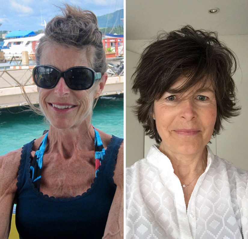 Antes y después: 20 ejemplos de personas que lograron superar la anorexia