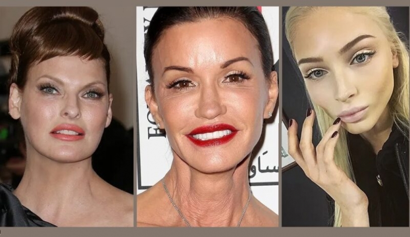 Beauty in the past: models who ruined her looks with plastic