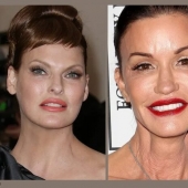 Beauty in the past: models who ruined her looks with plastic