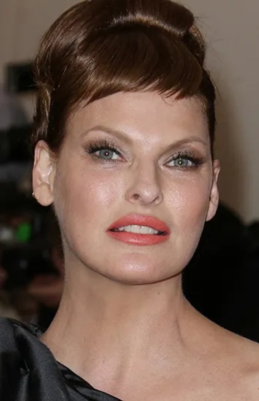 Beauty in the past: models who ruined her looks with plastic