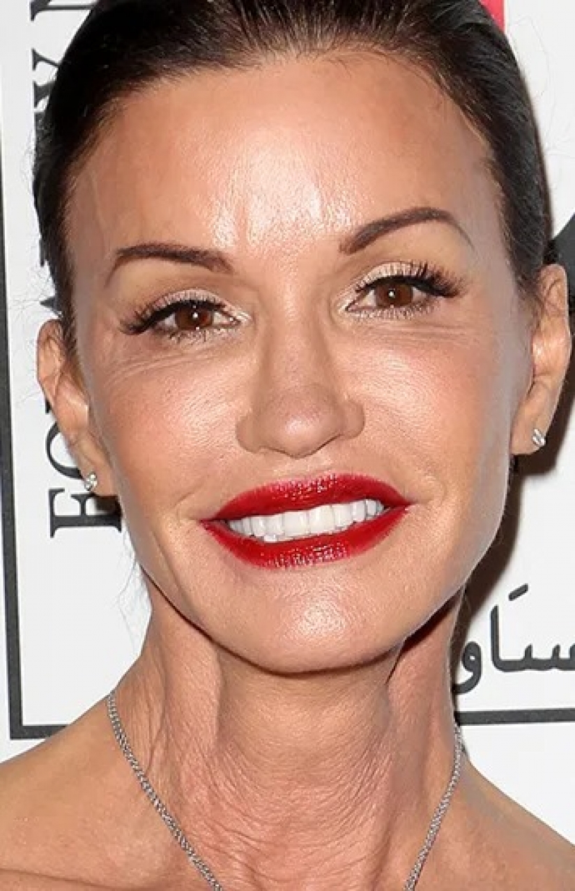 Beauty in the past: models who ruined her looks with plastic