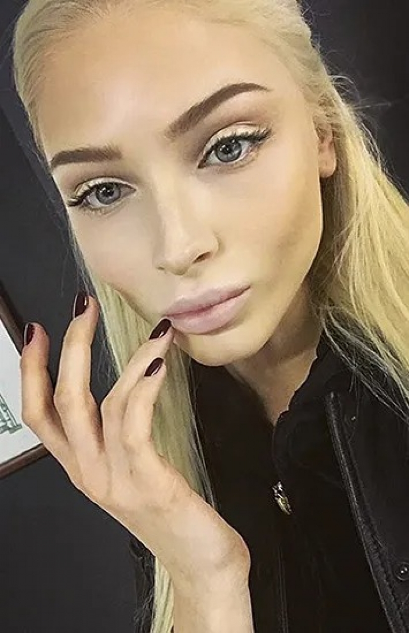 Beauty in the past: models who ruined her looks with plastic