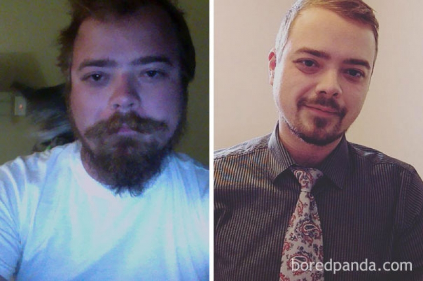 Before and after: how to change the appearance of the person who stops drinking