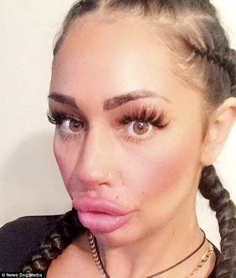 British dumplings: a single mother from Liverpool has spent nearly 2 thousand pounds for a swap of the lips and cannot stop