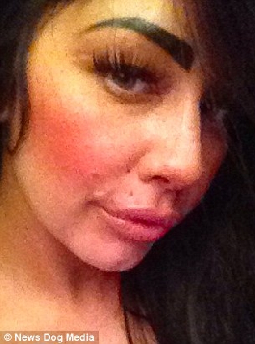 British dumplings: a single mother from Liverpool has spent nearly 2 thousand pounds for a swap of the lips and cannot stop