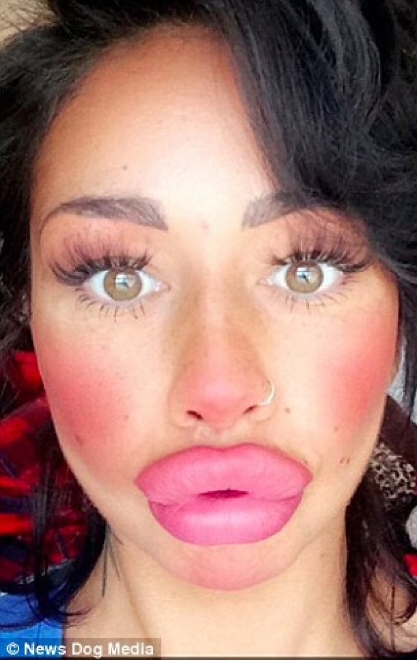 British dumplings: a single mother from Liverpool has spent nearly 2 thousand pounds for a swap of the lips and cannot stop