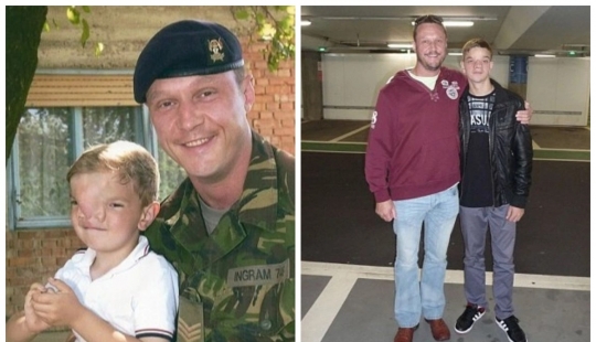 British soldiers raised money for an operation for a boy from Bosnia, who was born with a rare defect on the face
