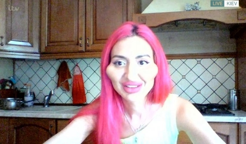 Cheeks-barrels: from Kiev itself injects fillers to be special