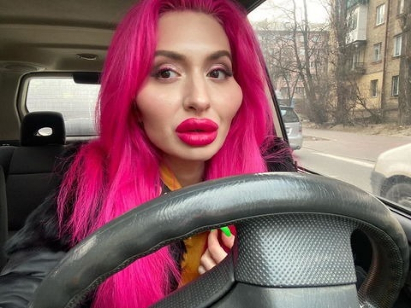 Cheeks-barrels: from Kiev itself injects fillers to be special