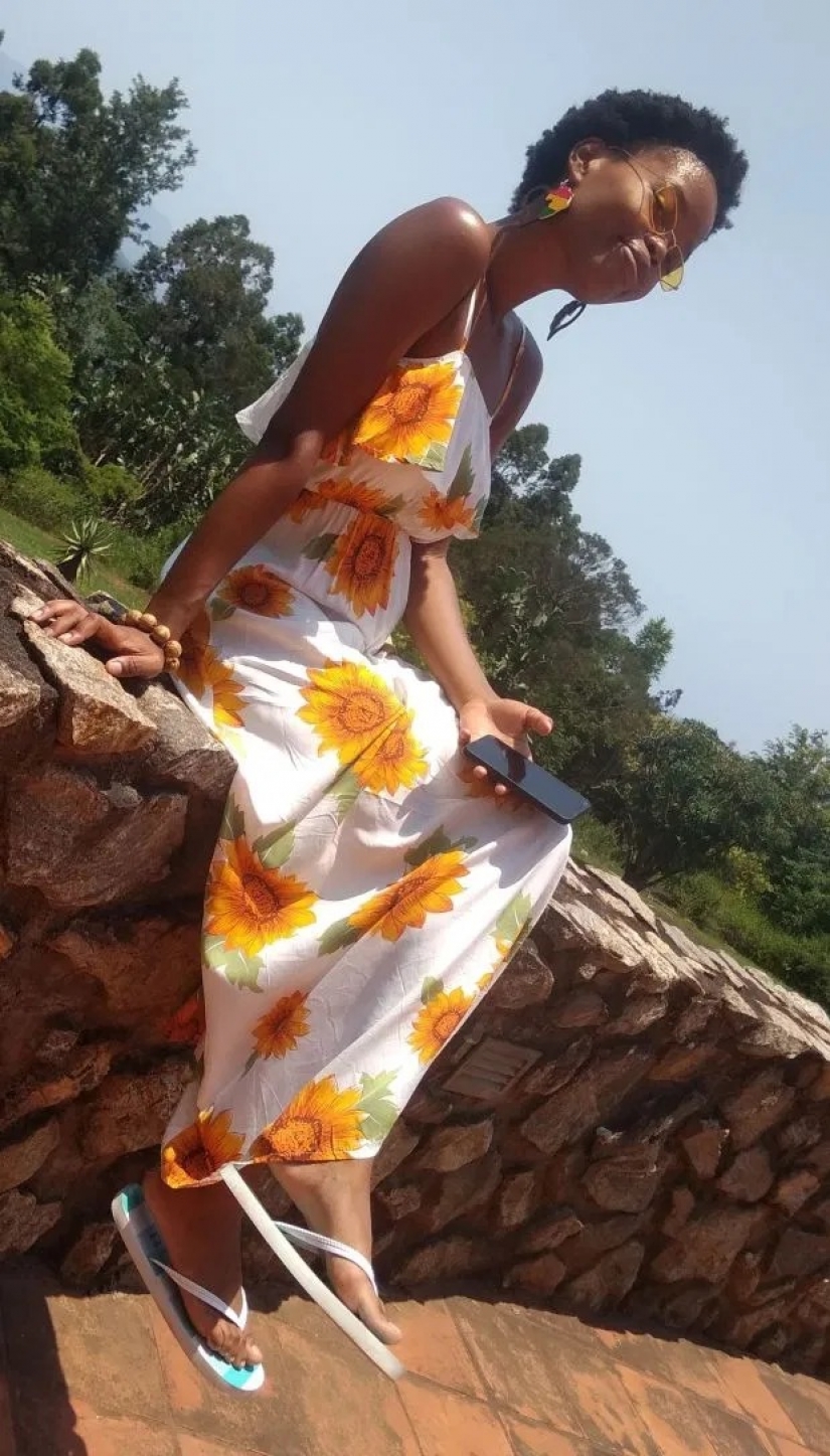 Como la piedra de alma: la vida de una niña con 13 tamaño de la mama ha cambiado drásticamente después de la cirugía de reducción de busto