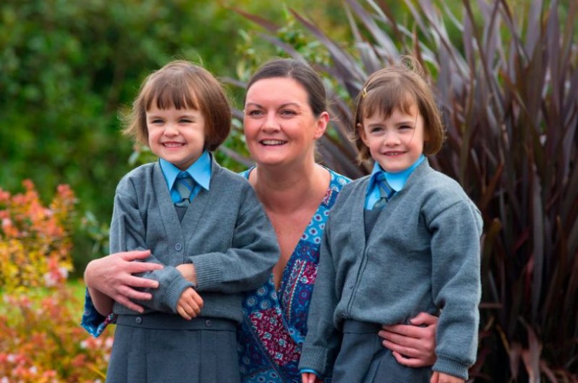 Connected by a single destiny: the miracle twins who were born with a break of 87 days