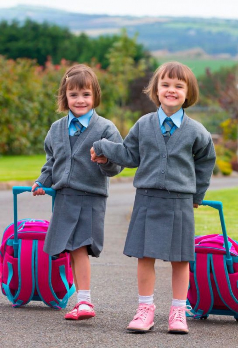 Connected by a single destiny: the miracle twins who were born with a break of 87 days