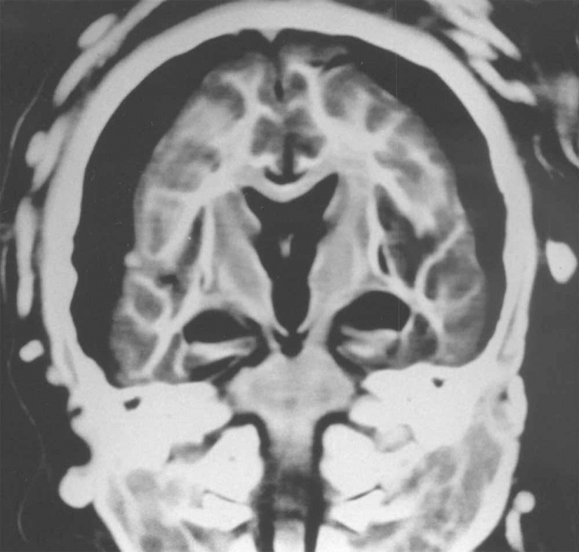 El Inca momias de sacrificar niños y mujeres