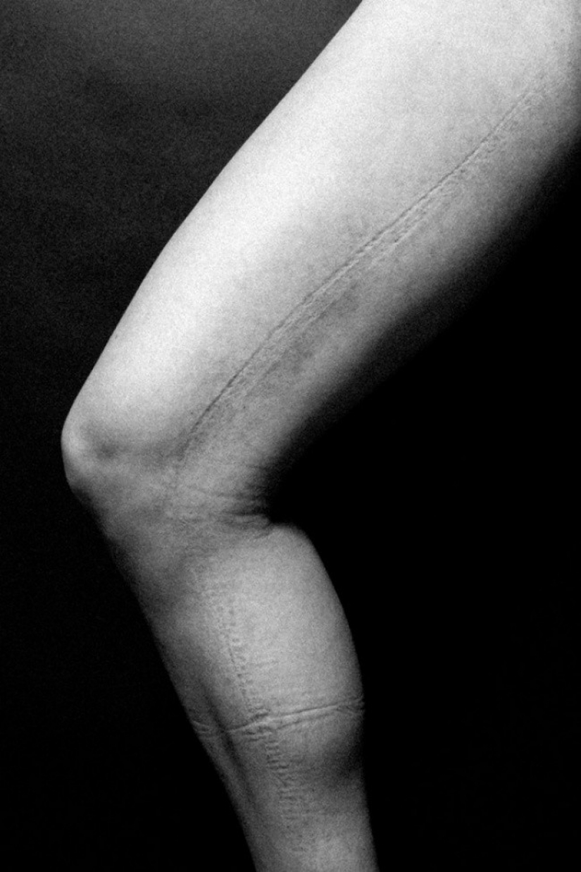 Esto es lo que está detrás de la hembra esplendor. En estas fotos aún es doloroso ver