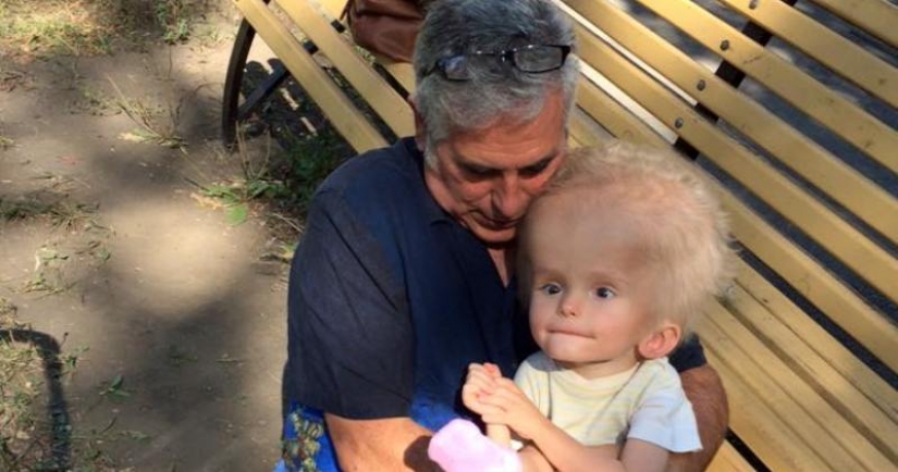 From a boy with an unusual head proved to be parents, but fate gave him a new family From a boy with an unusual head proved to be parents, but fate gave him a new family