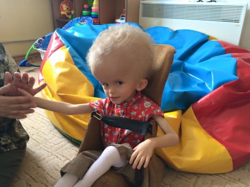 From a boy with an unusual head proved to be parents, but fate gave him a new family From a boy with an unusual head proved to be parents, but fate gave him a new family