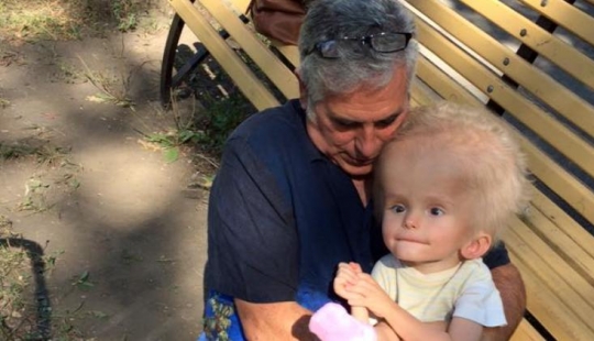 From a boy with an unusual head proved to be parents, but fate gave him a new family