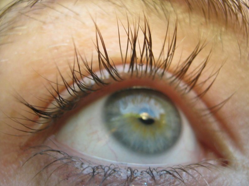 Genetic mutations attractive people Genetic mutations attractive people