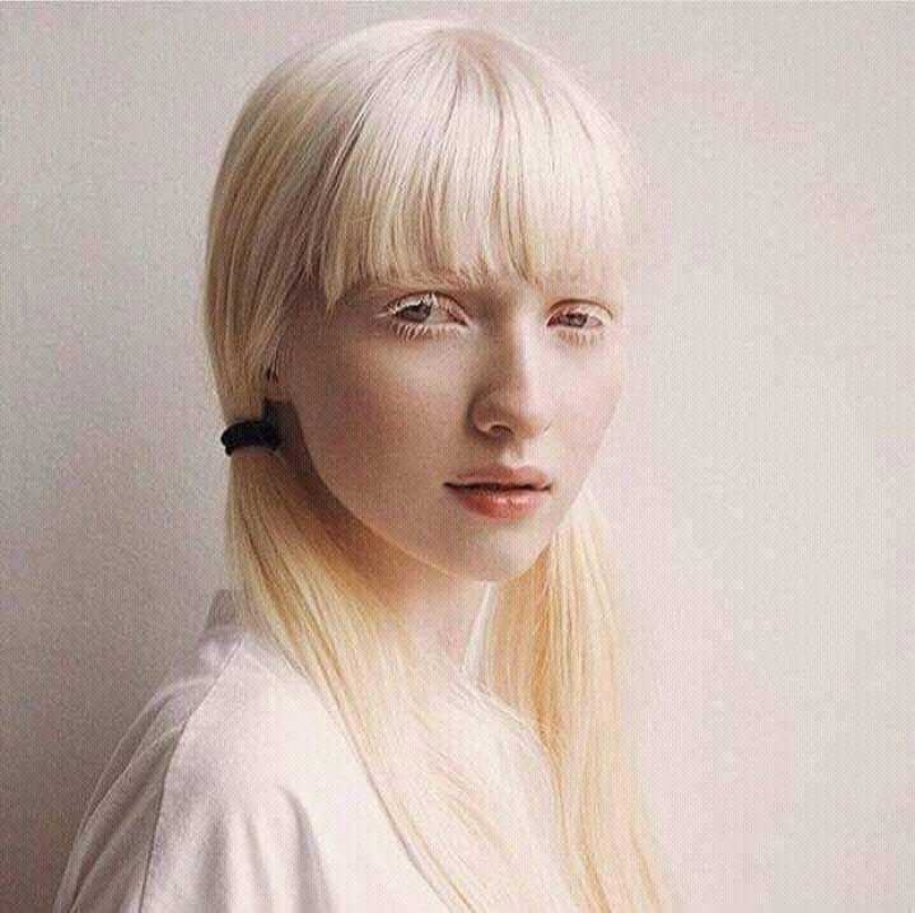 How are albinos different nationalities and races