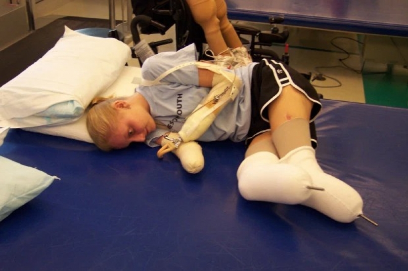 Imposible: la mujer sin brazos y piernas casaron, tuvieron dos hijos y se construyó una exitosa carrera