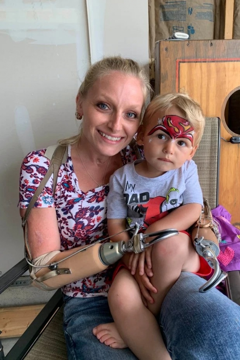 Impossible: woman without arms and legs got married, had two children and built a successful career