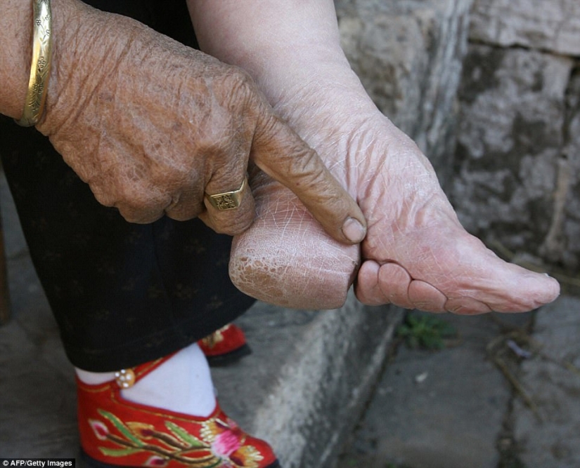 In the village of "bound feet" the last living Chinese women suffering from the ancient brutal tradition