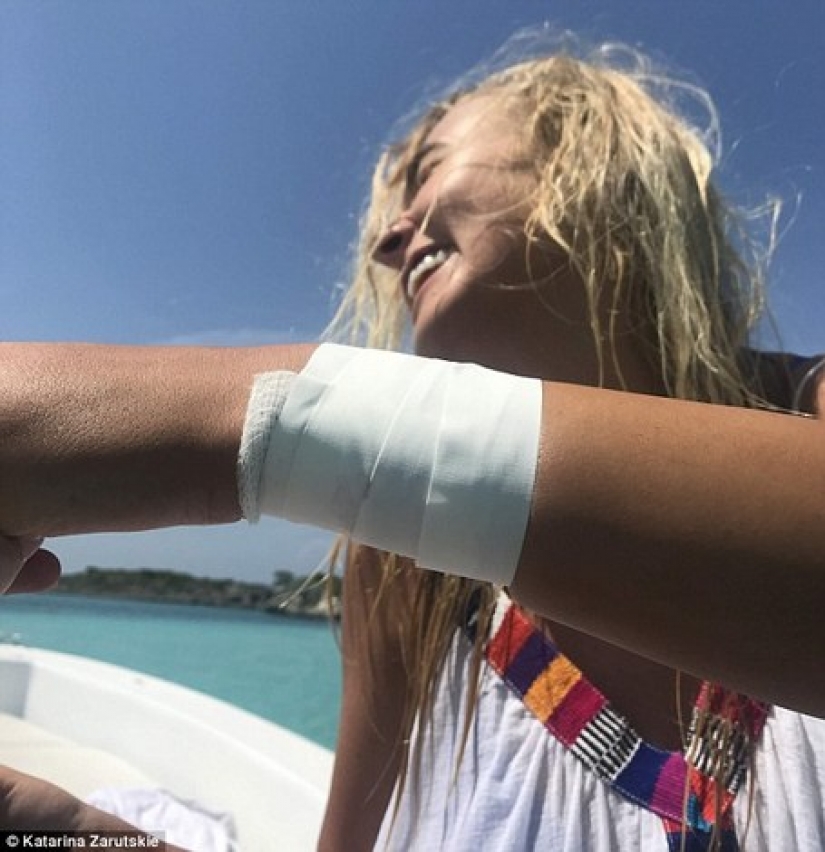 Instagram-the model climbed in the pool with the sharks for the sake of likes and almost lost my hand Instagram-the model climbed in the pool with the sharks for the sake of likes and almost lost my hand