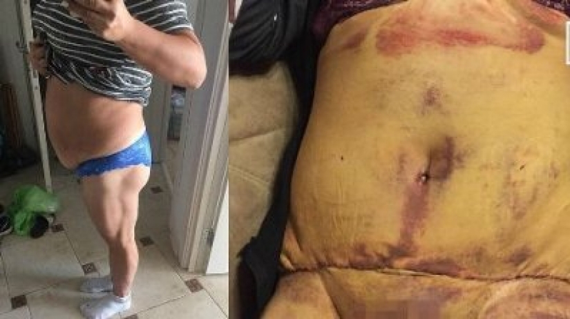 Krasnodar "Dr. Frankenstein," conducted plastic surgery in the kitchen and in the pantry Krasnodar "Dr. Frankenstein," conducted plastic surgery in the kitchen and in the pantry