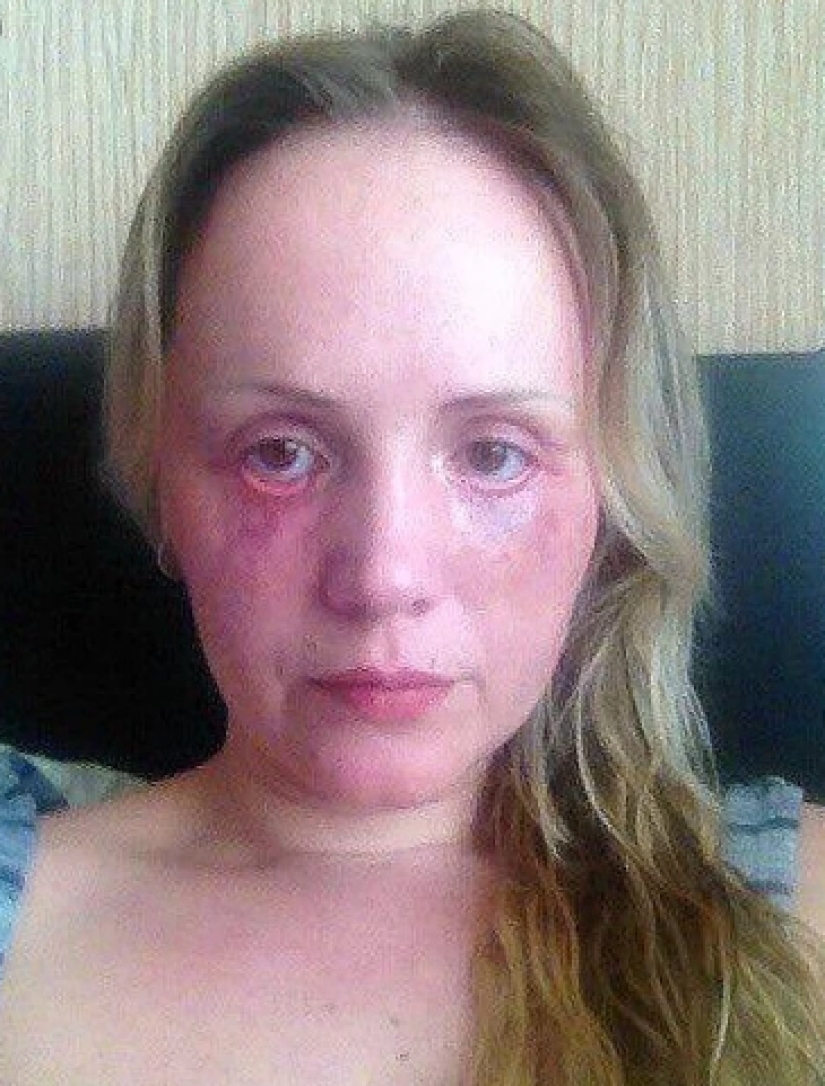 Krasnodar "Dr. Frankenstein," conducted plastic surgery in the kitchen and in the pantry Krasnodar "Dr. Frankenstein," conducted plastic surgery in the kitchen and in the pantry