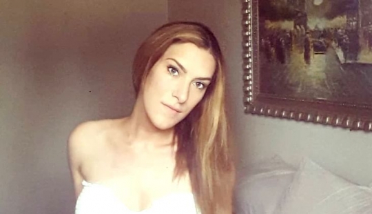 La chica poco a poco se convirtió feo y los médicos durante años no pudo encontrar la causa. Afortunadamente, todo terminó bien La chica poco a poco se convirtió feo y los médicos durante años no pudo encontrar la causa. Afortunadamente, todo terminó bien