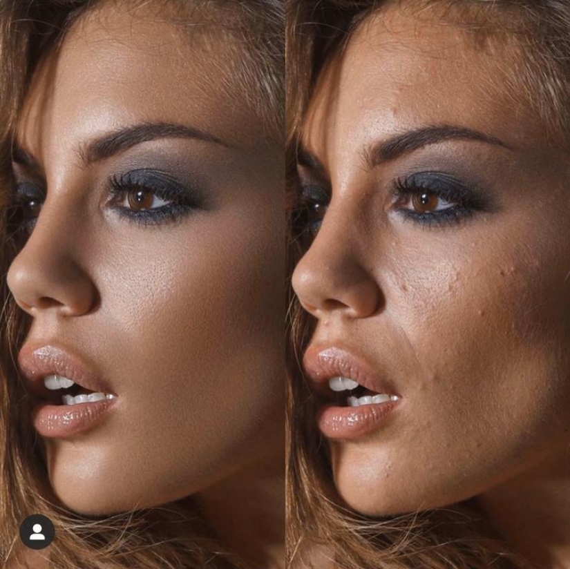 La dura verdad: 20 fotos de chicas en Internet y en la vida real La dura verdad: 20 fotos de chicas en Internet y en la vida real